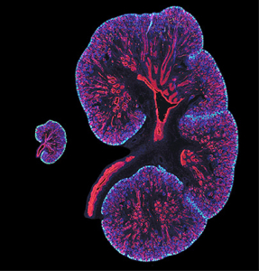 Embryonic day 15.5 mouse kidney next to a 15.5 week human fetal kidney with SIX2 (cyan) marking the nephron progenitor cells. The collecting duct system is red, and nuclei are in blue.