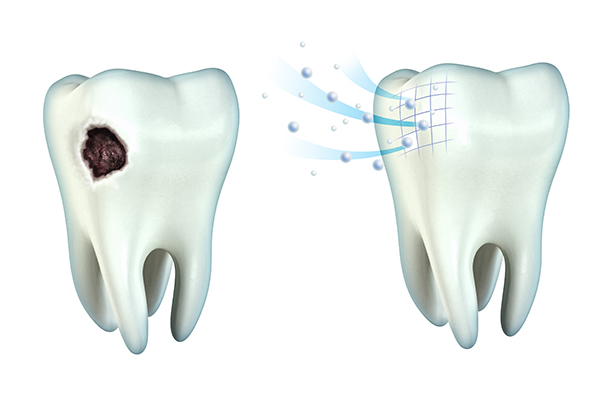 Researcher makes strides in gel to regrow tooth enamel