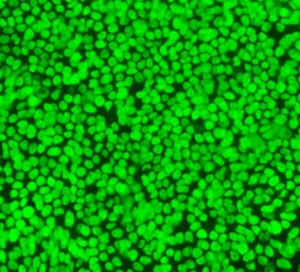 Qi-Long Ying and a team of researchers have discovered new ways to encourage human embryonic stem cells like these to self-renew. (Photo/Courtesy Qi-Long Ying)