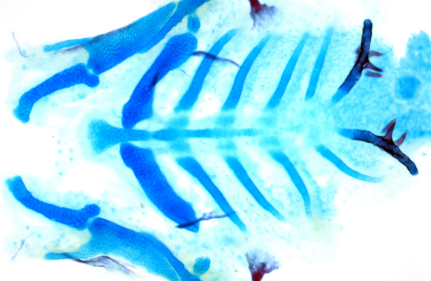 Dissection of the larval zebrafish skeleton shows facial cartilage — blue — and bone — red. (Image courtesy of the Crump Lab)
