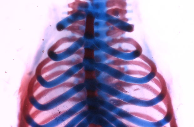 Mouse rib cage stained to show cartilage (blue) and bone (red). In adult mice, surgically removed sections of either portion can fully regenerate. (Image/Francesca Mariani)