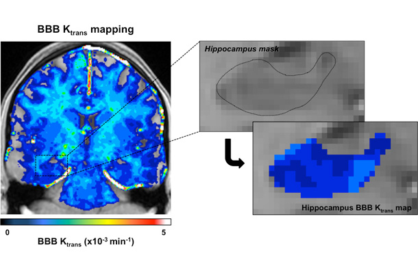 High-resolution imaging of the living human brain.