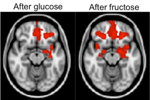 Scans show increased activity in reward areas of the brain from fructose as compared to glucose.