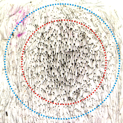 Plucking hairs from circular areas with diameters between three and five millimeters triggered the regeneration of between 450 and 1,300 hairs, including ones outside of the plucked region.