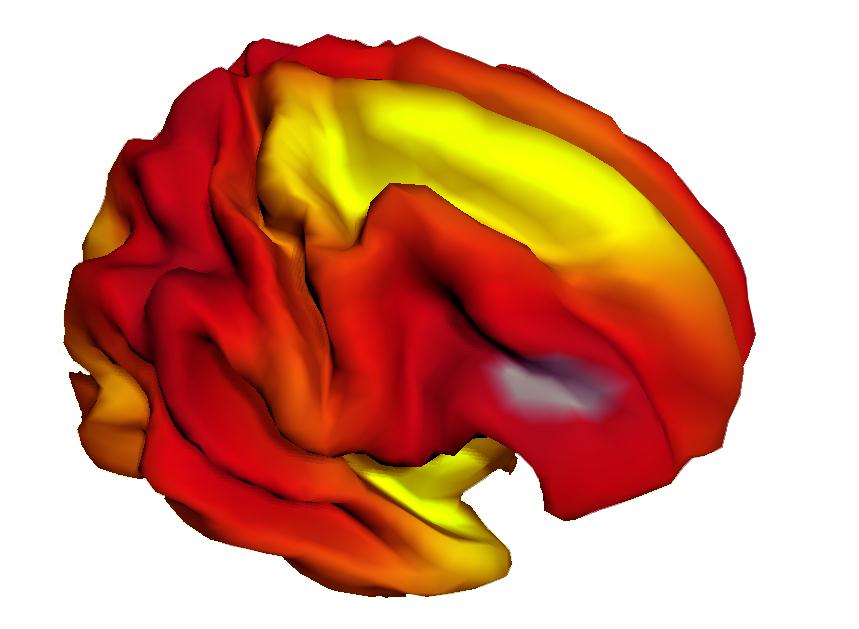 Composite image showing the relationship between brain surface expansion and age in children 3-20 years.