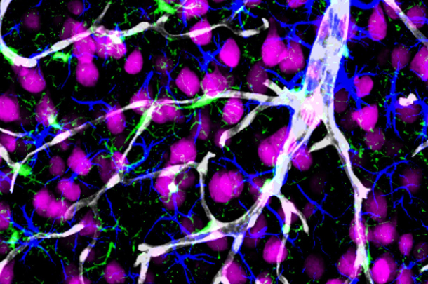 A snapshot of a neurovascular unit, consisting of neurons (pink), astrocytes (blue), resident microglia (green), a penetrating arteriole and capillaries (white) — the site of the blood-brain barrier and amyloid-beta  clearance.
 
