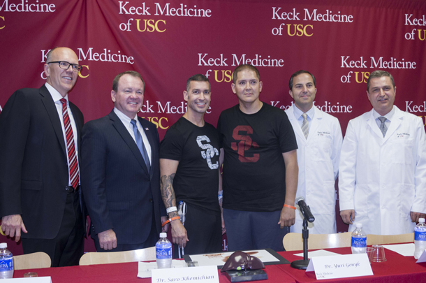 From left, Keck Medicine of USC CEO Tom Jackiewicz, L.A. County Sheriff Jim McDonnell, liver donor Javier Tiscareno, transplant recipient Jorge Castro, and doctors Saro Khemichian and Yuri Genyk of Keck Medicine of USC.