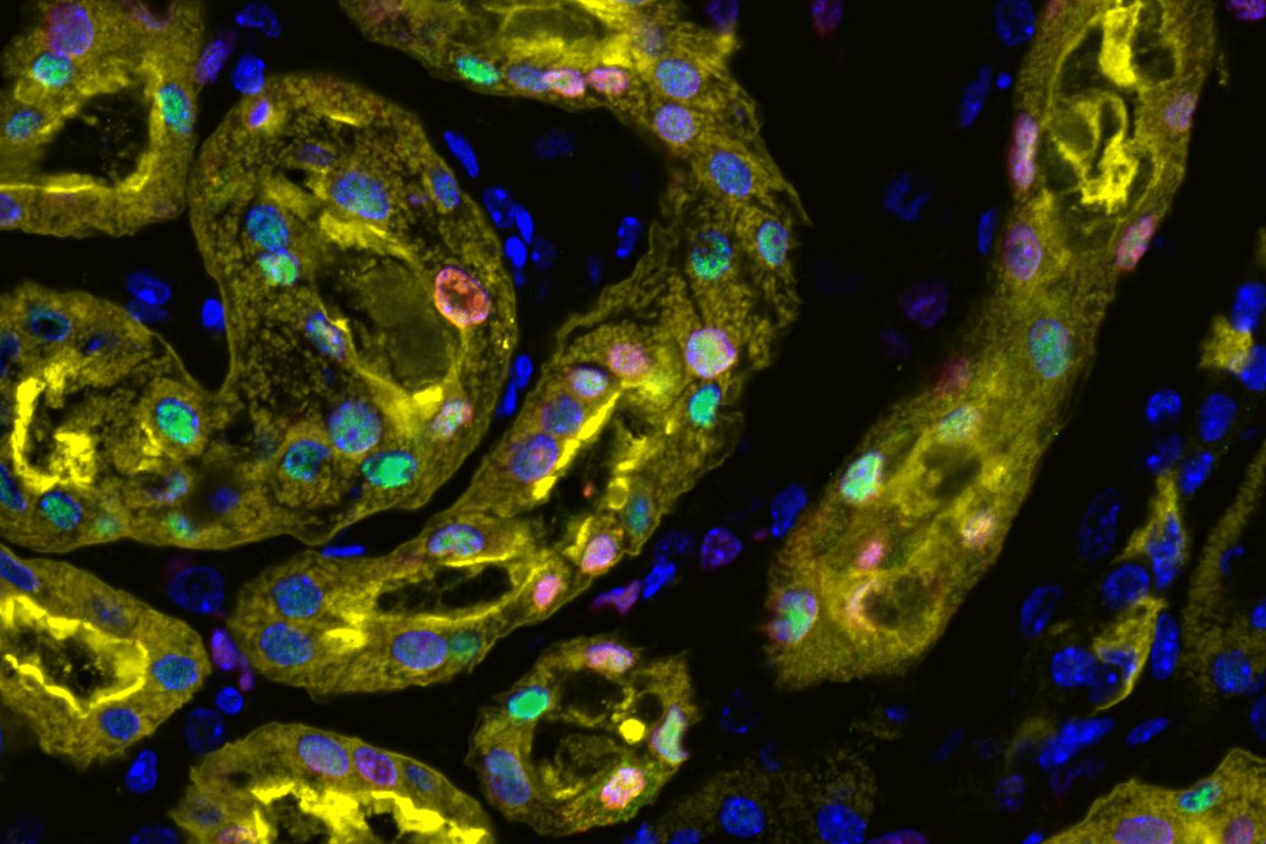 Activation of Sox9 (green) in nuclei (blue) of cellular lining (yellow) following acute nephron injury. Surviving SOX9+ cells proliferate (red) to repair the damaged nephron, restoring kidney function. 