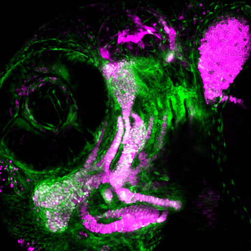 A three-day-old zebrafish head skeleton with newly differentiated cartilage cells (magenta) emerging from a pool of skeletal progenitor cells (green).
