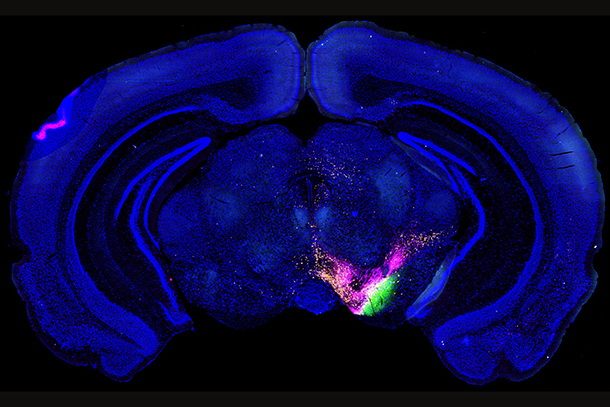 To understand how information is communicated throughout the brain, the mouse connectome project (MCP) uses multiple fluorescent-labeled dyes to trace the connections among all identified structures of the mouse brain. The dyes get injected into specific brain structures and get transported to target structures that are connected with the injection site. This image is one 50 micrometer-thick section of the mouse brain that contains labeling from three dyes injected into three different brain structures, indicating the unique connections of each injection.