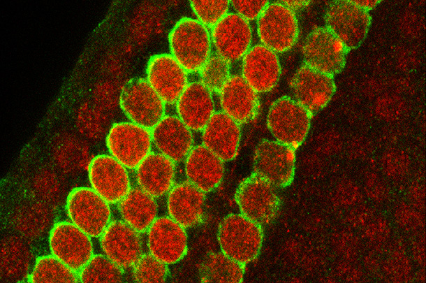 After treatments with cisplatin, the sensory hearing cells (green) of a one-day-old mouse show damaged DNA (red).