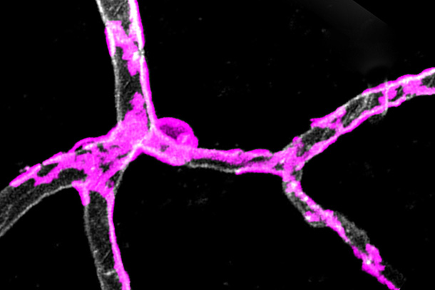 Pericytes, or gatekeeper cells, are wrapped around capillaries in the cortex of a mouse brain.