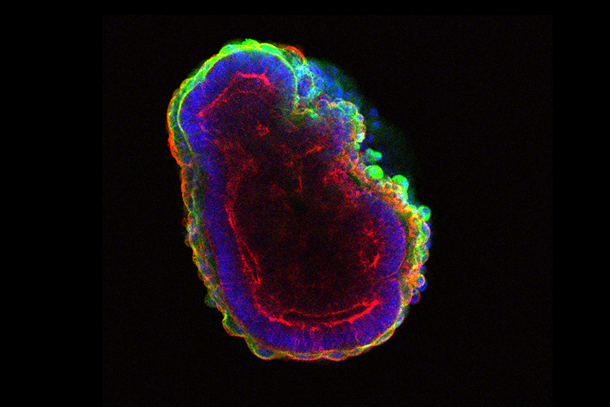 Stem cells self-organize to form a hollow ball of cells. 