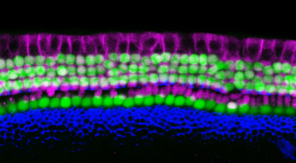 The organ of Corti, the hearing organ of the inner ear, is made up of a single row of inner hair cells and three rows of outer hair cells (green), surrounded by supporting cells (purple).