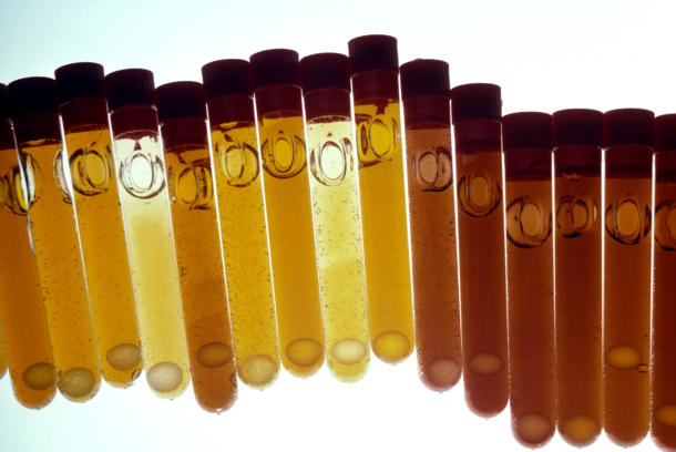 Certain medications or medical conditions can affect the color of urine. 
