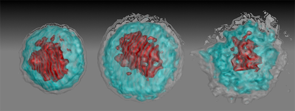 A healthy white blood cell, a cell infected by African Zika virus and a cell infected by Asian Zika virus, from left to right. 