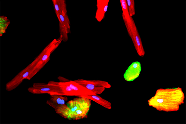 Heart muscle cells (red) with nuclei (blue). On the far right is a regenerative cell, which only has one nucleus, called a mononuclear diploid cardiomyocyte.