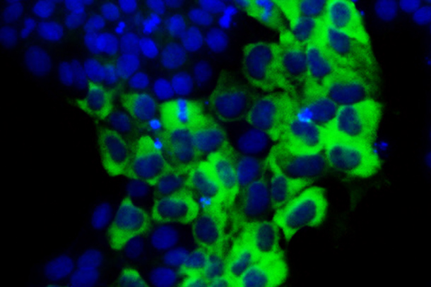 The protein TAZ (green) in the cytoplasm (the region outside of the nuclei, blue) promotes the self-renewal of human embryonic stem cells. 