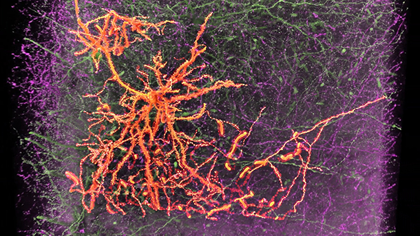 Hong-Wei Dong’s team collects data at the cellular level in the mouse brain; here, a neuron in the medial prefrontal cortex projects to the amygdala.