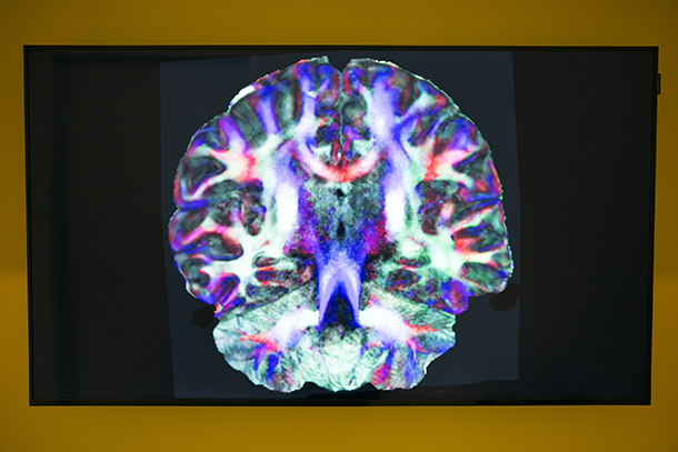 Researchers at the USC Stevens Neuroimaging and Informatics Institute will be responsible for 4,000 brain scans during the five-year study.
