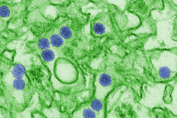 A digitally colorized view of the Zika virus, which causes microcephaly in babies.