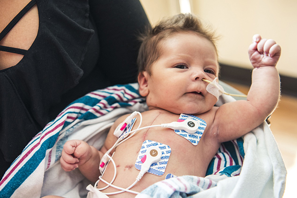 Baby Jasmine was born in late December with hypoplastic left heart syndrome (HLHS) and had her first open-heart surgery at 5 days old. She is enrolled in the groundbreaking clinical trial at Children’s Hospital Los Angeles.