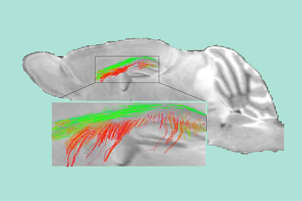 Diffusion MRI maps show disrupted white matter connectivity and loss of white matter fiber tracts in 1-year-old pericyte-deficient mice. 