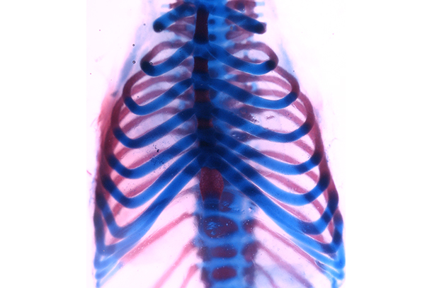 Mouse rib cage stained to show cartilage (blue) and bone (red).