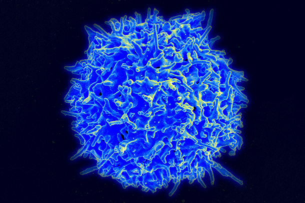 A healthy T cell 