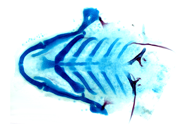 Skeletal staining of the lower face of a zebrafish, with cartilage in blue, and bones and teeth in red.