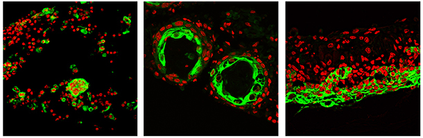 Two types of progenitor cells from dissociated skin — epidermal (green) and dermal (red) — undergo a series of morphological transitions to form reconstituted skin.