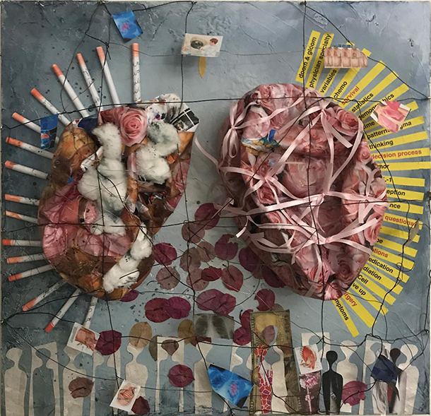 The Lung Is Pink is one of the exhibits in the latest installment of the Artist & Researcher series at the Hoyt Gallery on the Health Sciences Campus.