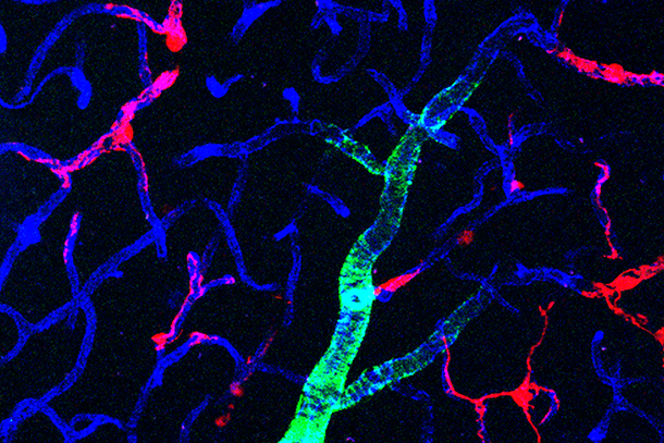 Capillaries in a mouse brain showing pericytes, which are labeled with a fluorescent red protein.