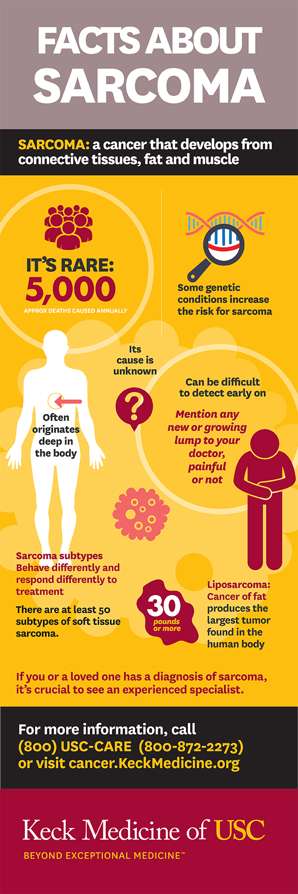 sarcoma cancer facts)