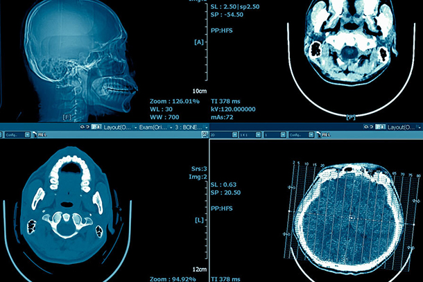 Researchers receive $12.5M grant for craniofacial research data-sharing endeavor