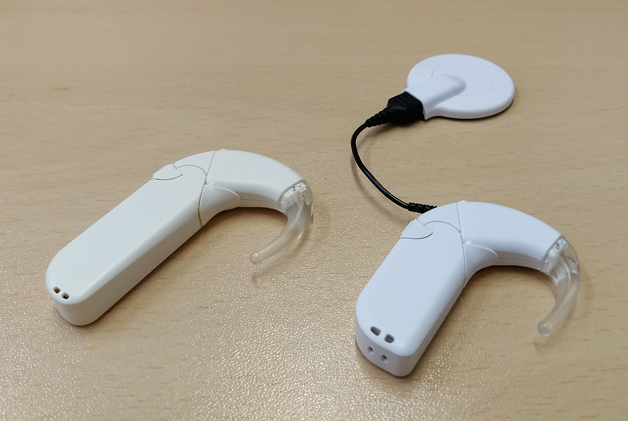 Used by roughly half a million people worldwide, a cochlear implant uses an external microphone and speech processor to relay impulses to electrodes implanted in the ear that send sound signals to the brain.
