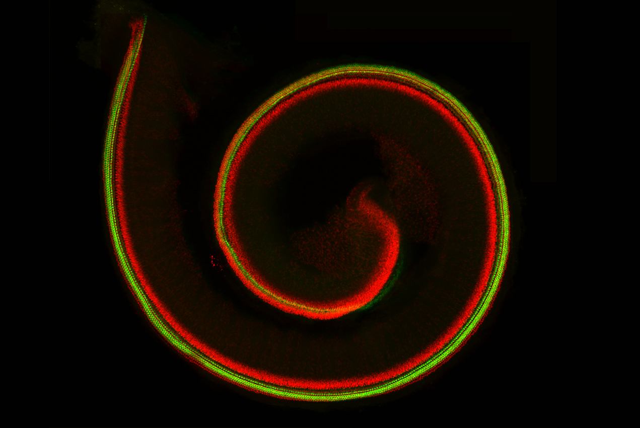In a developing mouse, the Organ of Corti contains sensory cells (green) and supporting cells (red). 