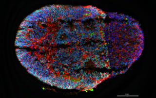 A rendering shows color-coded parts of a cortical organoid.
