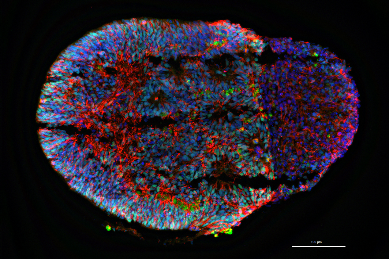 Scientists will study these brain organoids, mapping the electrophysiological and genetic activities of different types of nerve cells.