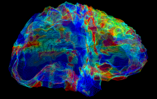 Multicolored imaging depicts a human brain.