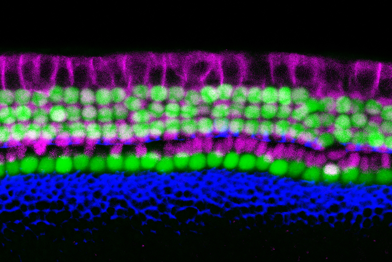 An organ of Corti from a one-day-old mouse, showing sensory hair cells in green, supporting cells in purple, and cell nuclei in blue.
