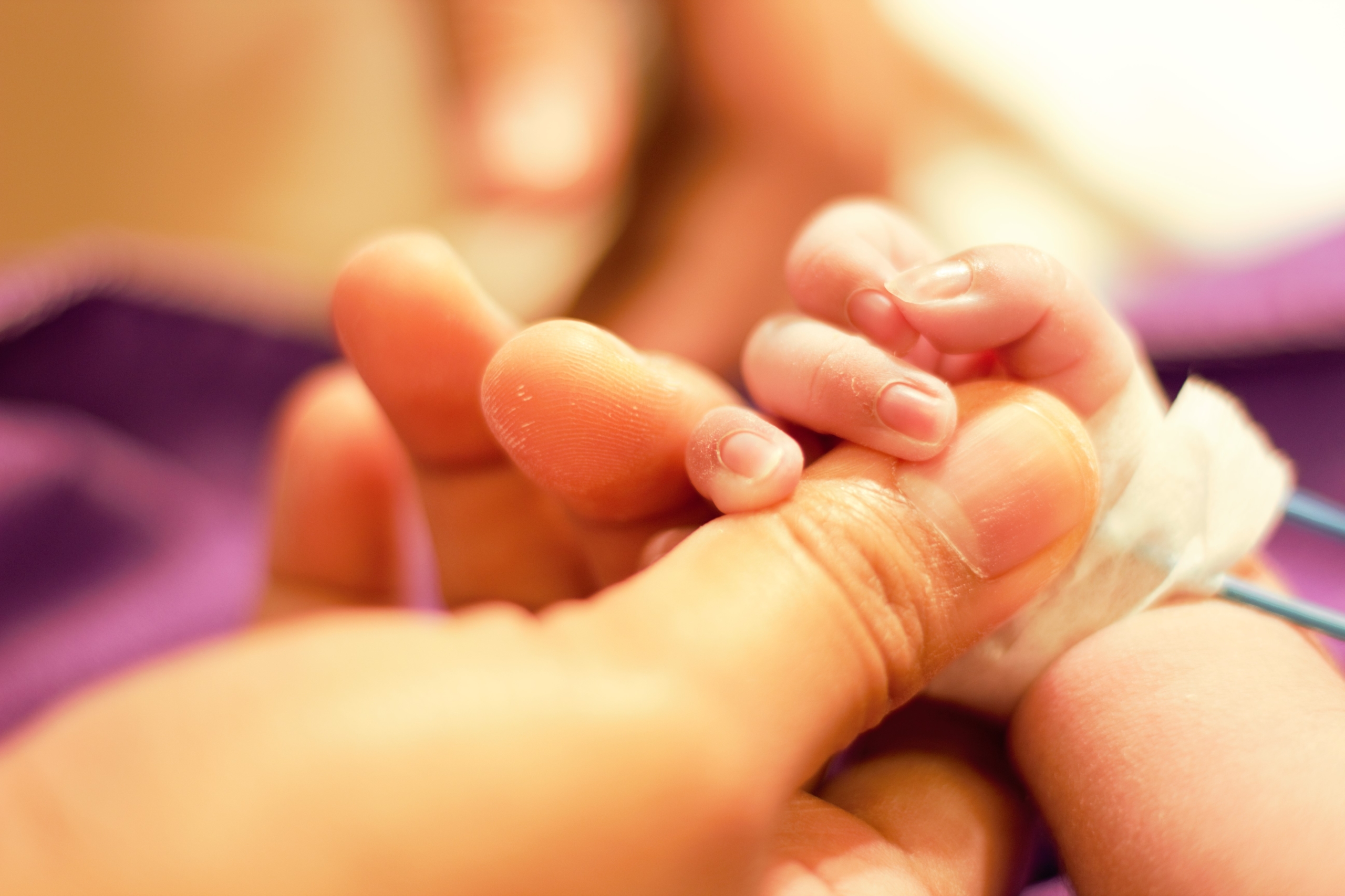 Occupational therapists in the neonatal ICU approach the work from both neuroprotective and rehabilitative perspectives.