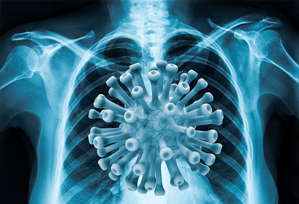 Radiologists were among the first in early 2020 to offer health care professionals an in-depth look at what the novel coronavirus infection was doing to the human body.