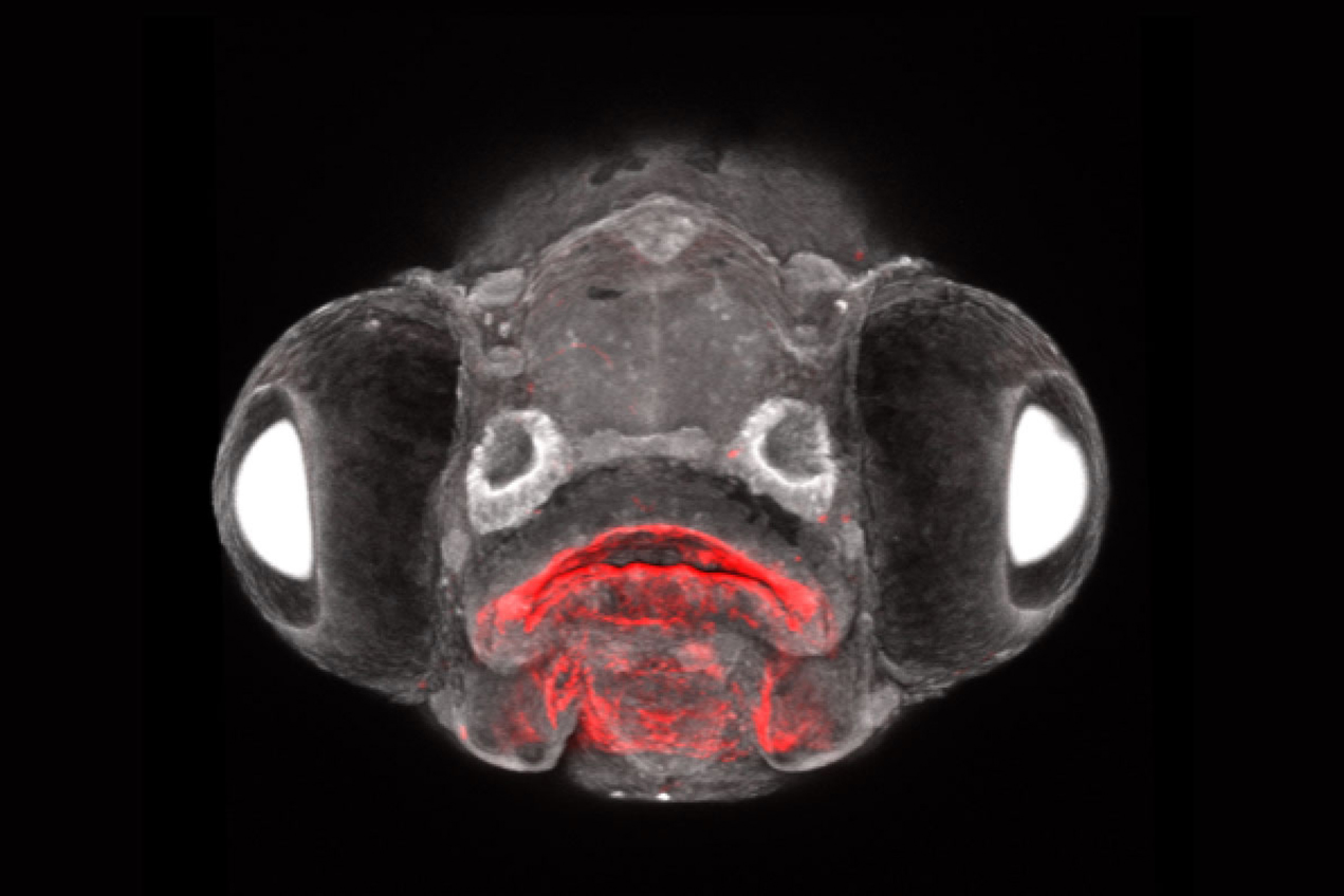 A larval zebrafish face shows that a type of endoderm cell (red) makes unexpected contributions to the pituitary gland.