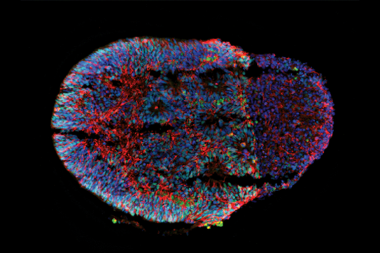 Researchers from the Keck School of Medicine of USC and the USC Viterbi School of Engineering are looking to improve the creation of organoid models, such as this 15-day-old brain organoid, which can advance understanding of brain development and disorders.