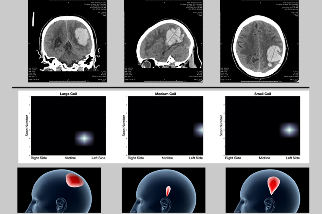 A series of brain imaging scans