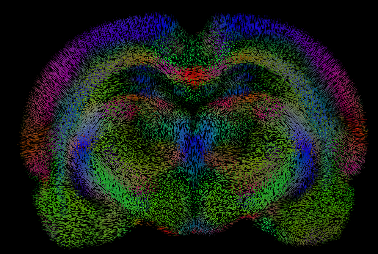 This rendering of the rat brain was created using the Quantitative Imaging Toolkit created by Ryan Cabeen, PhD.