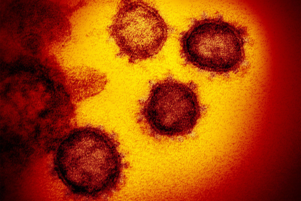 An electronic microscope image shows the virus that causes COVID-19.