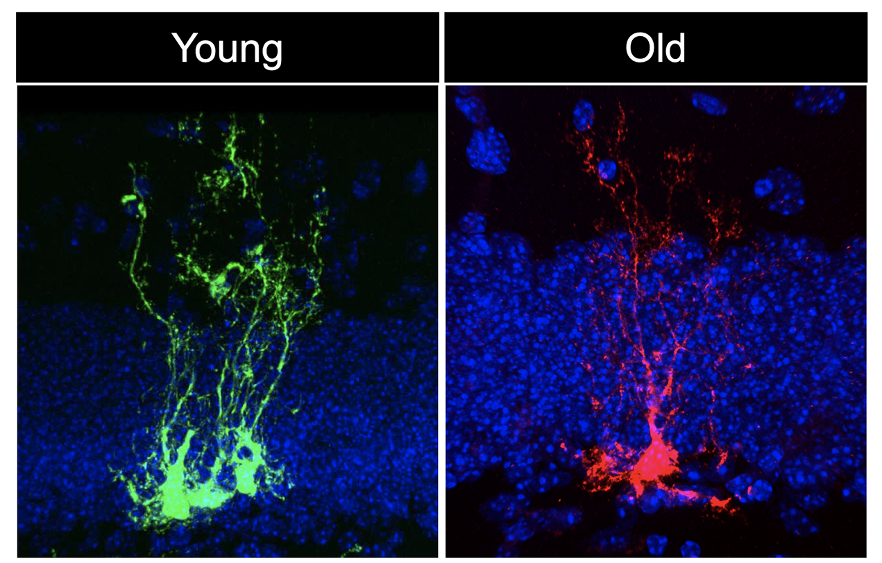 Neural stem cell clones in young (green) and old (red) mouse brains.