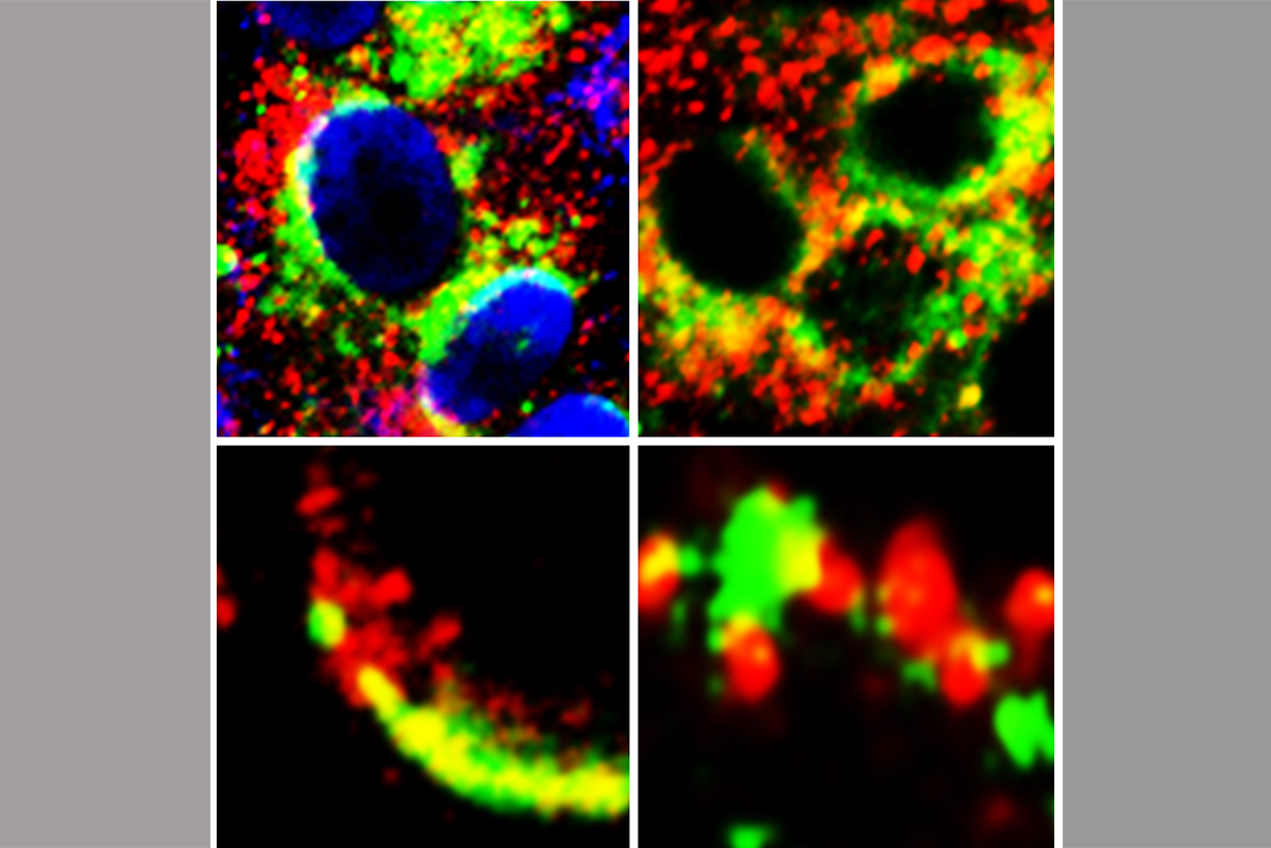 Images of cells showing close proximity (yellow) of GRP78 (green) with Spike protein of SARS-Cov-2 (red) (left panels) and ACE2 (red) (right panels).